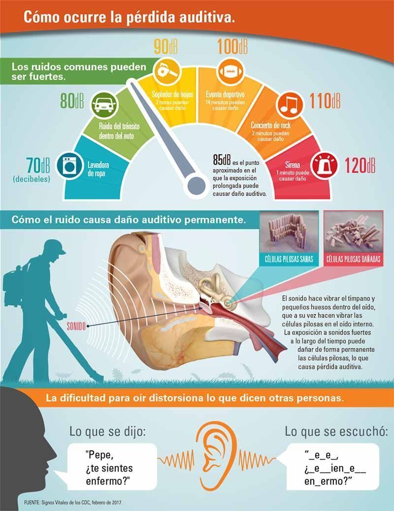 como ocurre la pérdida auditiva