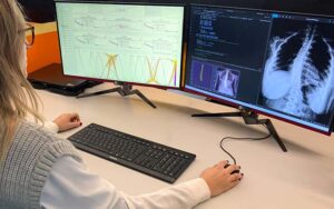 Inteligencia Artificial para mejorar el diagnóstico de la escoliosis